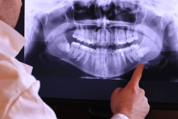Best Emergency Treatment for Dental Infections or Abscesses in Amboy, IL